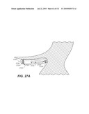 DIAGNOSTIC CATHETERS, GUIDE CATHETERS, VISUALIZATION DEVICES AND CHORD MANIPULATION DEVICES, AND RELATED KITS AND METHODS diagram and image