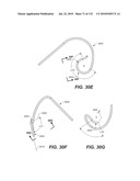 DIAGNOSTIC CATHETERS, GUIDE CATHETERS, VISUALIZATION DEVICES AND CHORD MANIPULATION DEVICES, AND RELATED KITS AND METHODS diagram and image