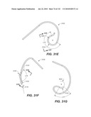 DIAGNOSTIC CATHETERS, GUIDE CATHETERS, VISUALIZATION DEVICES AND CHORD MANIPULATION DEVICES, AND RELATED KITS AND METHODS diagram and image