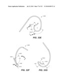 DIAGNOSTIC CATHETERS, GUIDE CATHETERS, VISUALIZATION DEVICES AND CHORD MANIPULATION DEVICES, AND RELATED KITS AND METHODS diagram and image