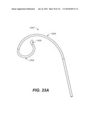 DIAGNOSTIC CATHETERS, GUIDE CATHETERS, VISUALIZATION DEVICES AND CHORD MANIPULATION DEVICES, AND RELATED KITS AND METHODS diagram and image