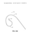 DIAGNOSTIC CATHETERS, GUIDE CATHETERS, VISUALIZATION DEVICES AND CHORD MANIPULATION DEVICES, AND RELATED KITS AND METHODS diagram and image