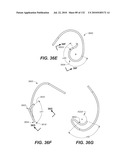 DIAGNOSTIC CATHETERS, GUIDE CATHETERS, VISUALIZATION DEVICES AND CHORD MANIPULATION DEVICES, AND RELATED KITS AND METHODS diagram and image