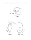 DIAGNOSTIC CATHETERS, GUIDE CATHETERS, VISUALIZATION DEVICES AND CHORD MANIPULATION DEVICES, AND RELATED KITS AND METHODS diagram and image