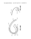 DIAGNOSTIC CATHETERS, GUIDE CATHETERS, VISUALIZATION DEVICES AND CHORD MANIPULATION DEVICES, AND RELATED KITS AND METHODS diagram and image