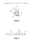 NEEDLED CANNULA WITH FILTER DEVICE diagram and image