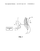 DISPLAY OF SUPPLEMENTAL BOLUS IN RELATION TO PROGRAMMED DOSE diagram and image