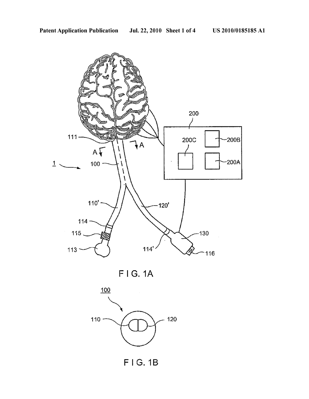 System and Method for Correction of Intracerebral Chemical Imbalances - diagram, schematic, and image 02