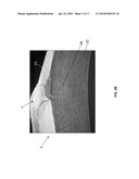 EYE THERAPY SYSTEM diagram and image