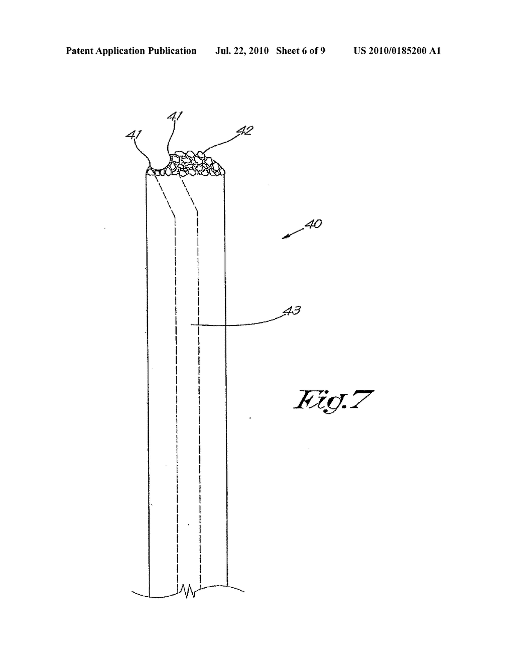 STRUCTURE FOR FORMING BONE - diagram, schematic, and image 07