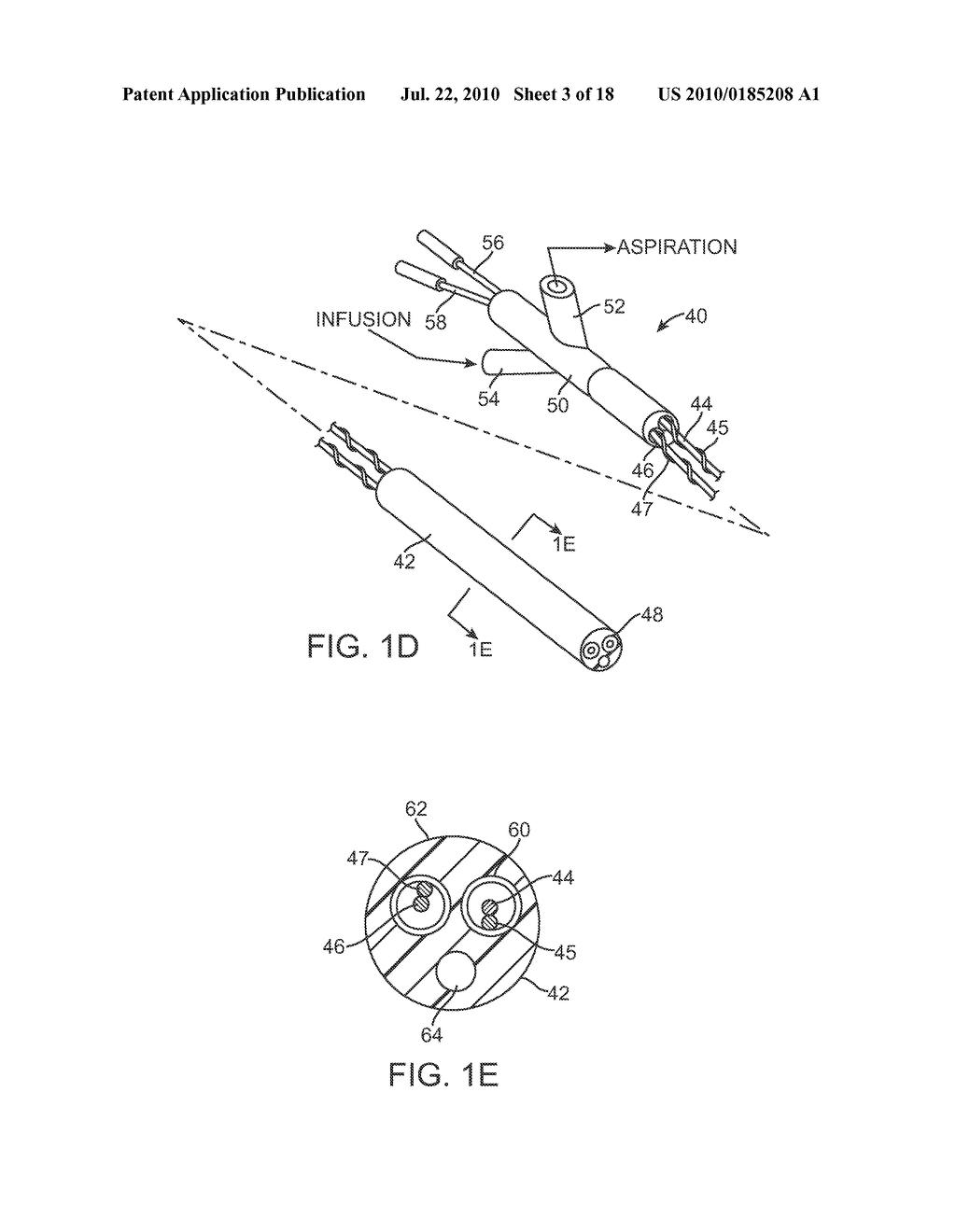 MECHANICAL PUMP FOR REMOVAL OF FRAGMENTED MATTER AND METHODS OF MANUFACTURE AND USE - diagram, schematic, and image 04