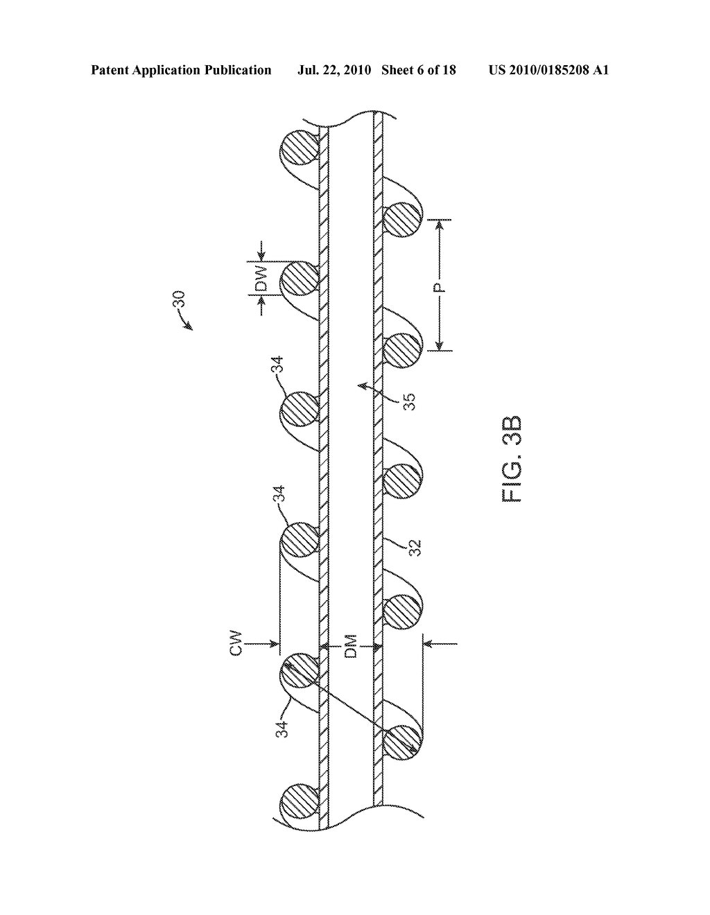 MECHANICAL PUMP FOR REMOVAL OF FRAGMENTED MATTER AND METHODS OF MANUFACTURE AND USE - diagram, schematic, and image 07