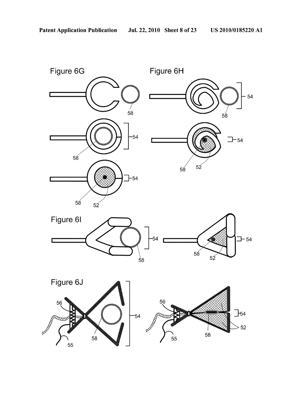 APPARATUS AND METHODS FOR CONTROLLED ISCHEMIC CONDITIONING - diagram, schematic, and image 09