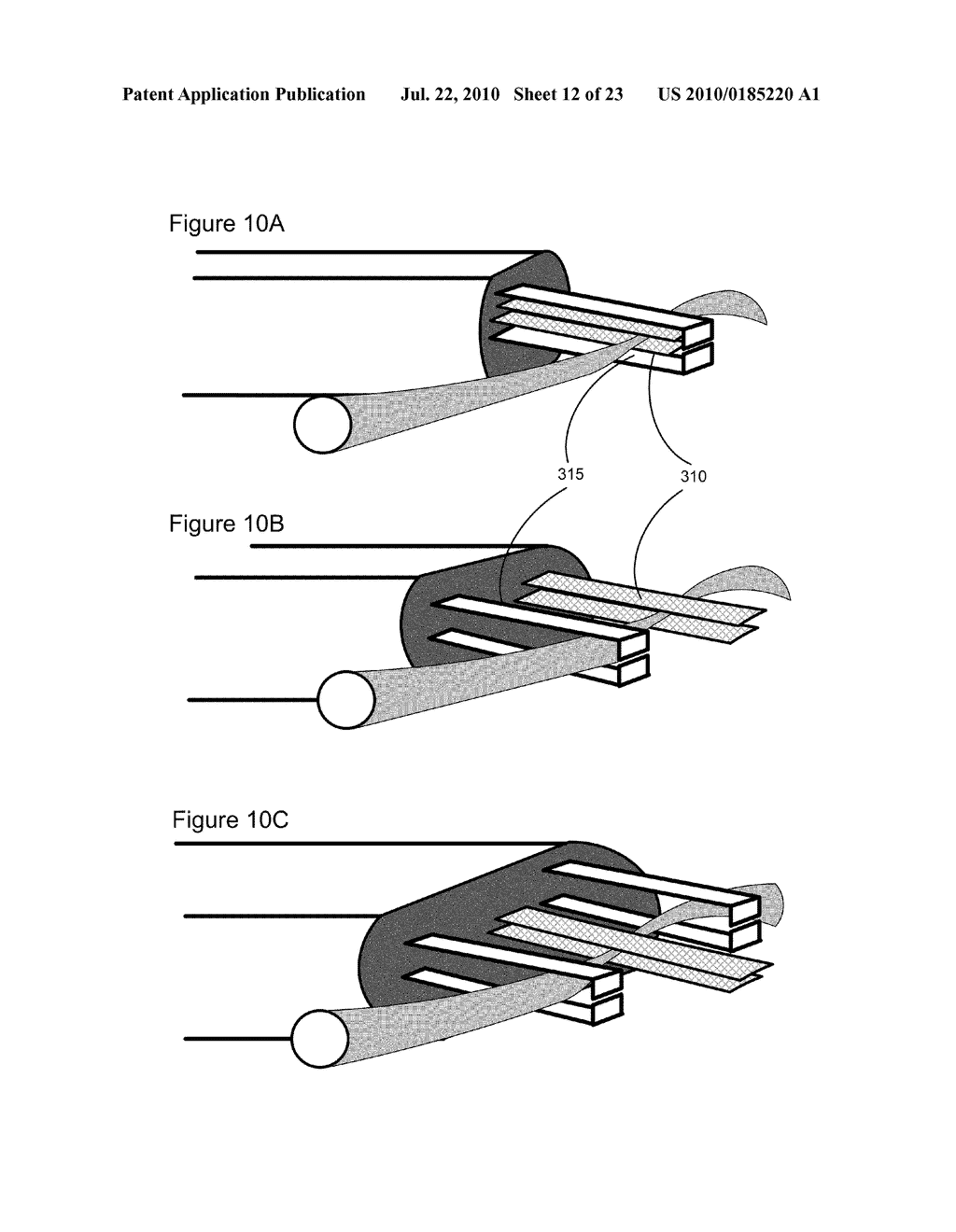 APPARATUS AND METHODS FOR CONTROLLED ISCHEMIC CONDITIONING - diagram, schematic, and image 13