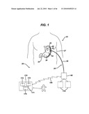 GUI FOR AN IMPLANTABLE DISTENSION DEVICE AND A DATA LOGGER diagram and image