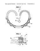 GUI FOR AN IMPLANTABLE DISTENSION DEVICE AND A DATA LOGGER diagram and image