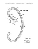 GUI FOR AN IMPLANTABLE DISTENSION DEVICE AND A DATA LOGGER diagram and image