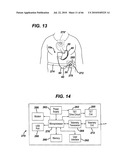 GUI FOR AN IMPLANTABLE DISTENSION DEVICE AND A DATA LOGGER diagram and image