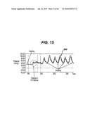 GUI FOR AN IMPLANTABLE DISTENSION DEVICE AND A DATA LOGGER diagram and image