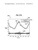 GUI FOR AN IMPLANTABLE DISTENSION DEVICE AND A DATA LOGGER diagram and image