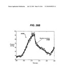 GUI FOR AN IMPLANTABLE DISTENSION DEVICE AND A DATA LOGGER diagram and image