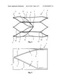 VASCULAR FILTER diagram and image