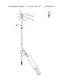 Occluding Device diagram and image