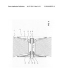 Occluding Device diagram and image