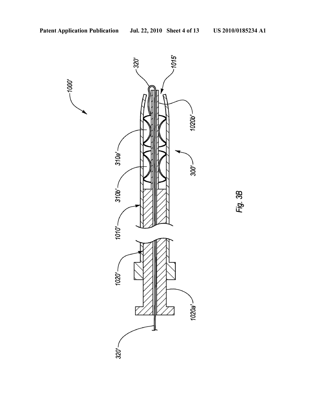 CLOSURE DEVICES, SYSTEMS, AND METHODS - diagram, schematic, and image 05