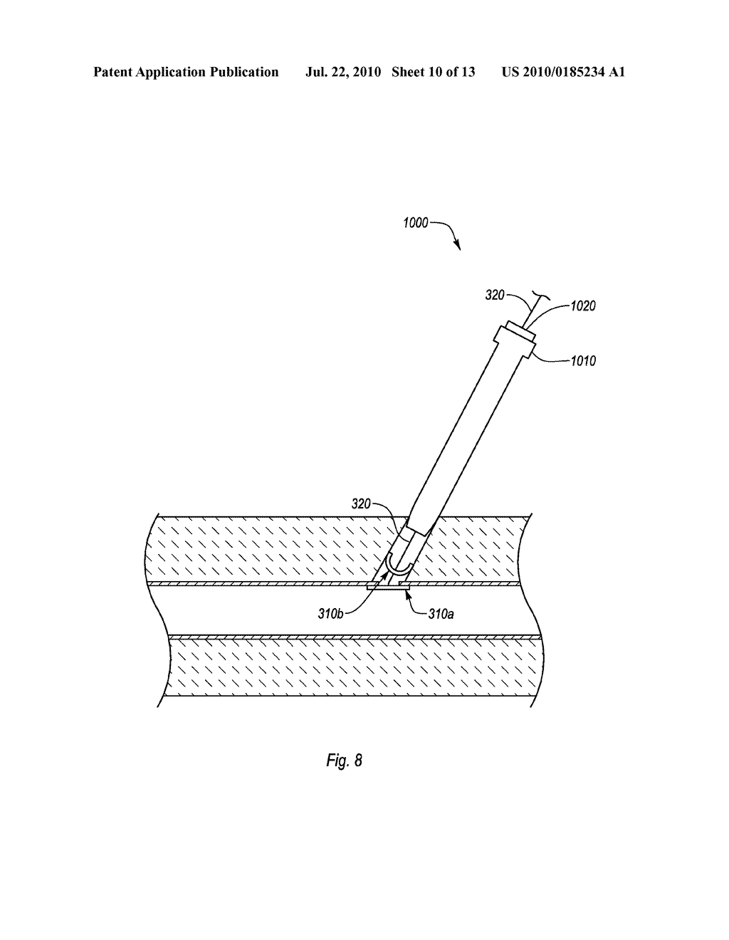 CLOSURE DEVICES, SYSTEMS, AND METHODS - diagram, schematic, and image 11