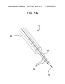 SYSTEMS AND METHODS FOR CLOSING AN APERTURE IN A BODILY TISSUE diagram and image