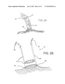 SYSTEMS AND METHODS FOR CLOSING AN APERTURE IN A BODILY TISSUE diagram and image