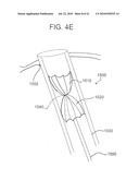 SYSTEMS AND METHODS FOR CLOSING AN APERTURE IN A BODILY TISSUE diagram and image