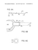 SYSTEMS AND METHODS FOR CLOSING AN APERTURE IN A BODILY TISSUE diagram and image