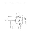 SYSTEMS AND METHODS FOR CLOSING AN APERTURE IN A BODILY TISSUE diagram and image