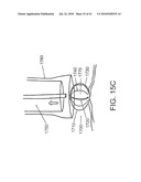 SYSTEMS AND METHODS FOR CLOSING AN APERTURE IN A BODILY TISSUE diagram and image