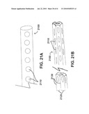 SYSTEMS AND METHODS FOR CLOSING AN APERTURE IN A BODILY TISSUE diagram and image