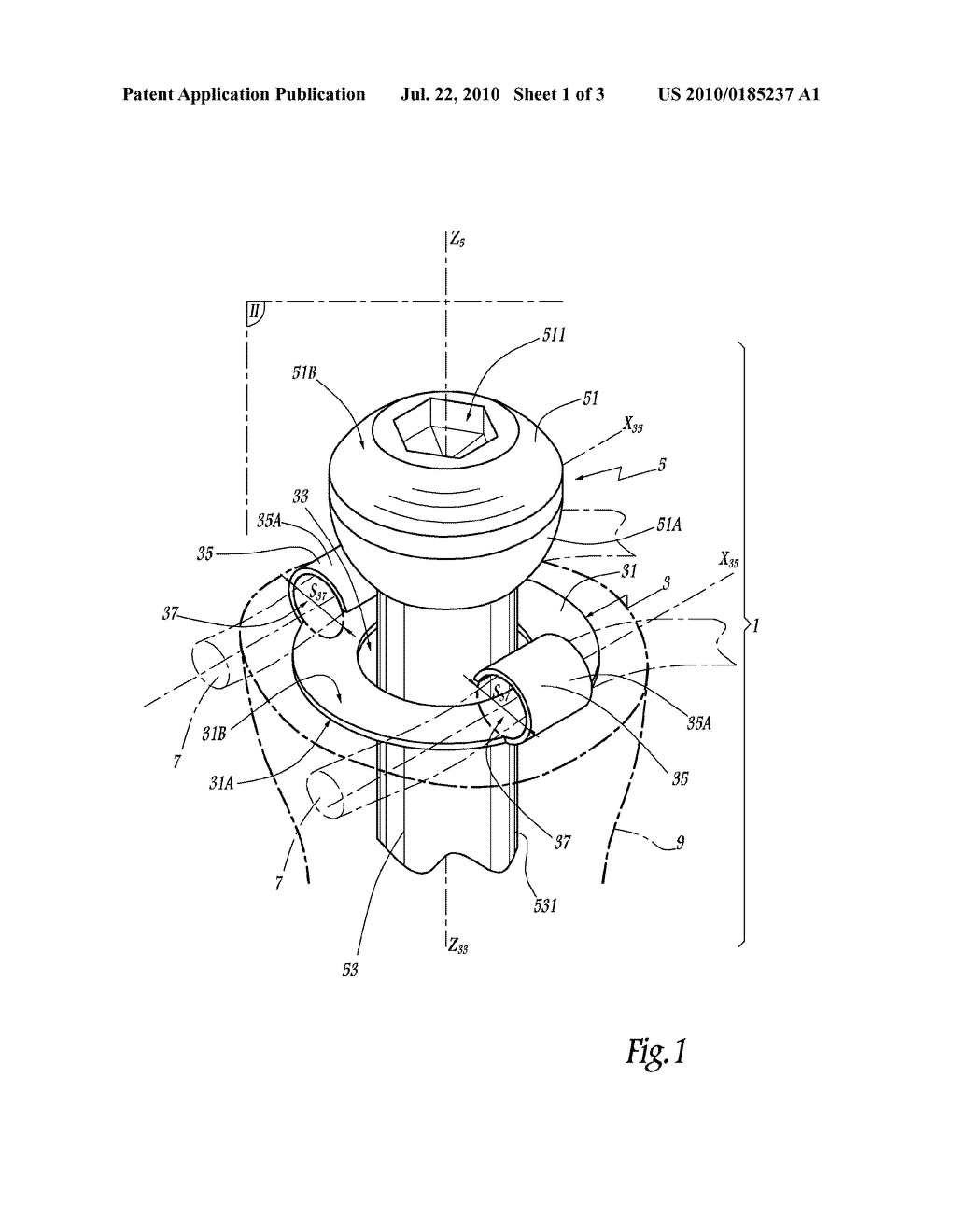 DEVICE FOR ATTACHING SUTURE THREADS - diagram, schematic, and image 02