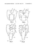 INTERVERTEBRAL IMPLANT FOR THE LUMBROSACRAL ARTICULATION diagram and image