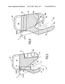 INTERVERTEBRAL IMPLANT FOR THE LUMBROSACRAL ARTICULATION diagram and image