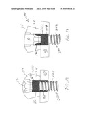 Screw Locking Systems for Bone Plates diagram and image