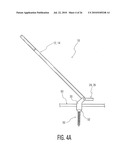 Rod Coercer diagram and image