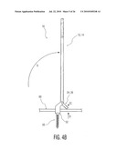 Rod Coercer diagram and image