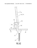 Rod Coercer diagram and image