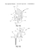 Rod Coercer diagram and image