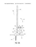 Rod Coercer diagram and image