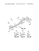 Surgical Guide and Method for Guiding a Therapy Delivery Device into the Pterygopalatine Fossa diagram and image