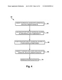 Surgical Guide and Method for Guiding a Therapy Delivery Device into the Pterygopalatine Fossa diagram and image