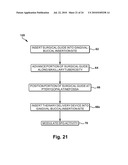 Surgical Guide and Method for Guiding a Therapy Delivery Device into the Pterygopalatine Fossa diagram and image