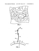 CORPUS CALLOSUM NEUROMODULATION ASSEMBLY diagram and image